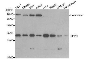 Western blot analysis of extracts of various cell lines, using SPIN1 antibody. (Spindlin 1 Antikörper  (AA 1-262))