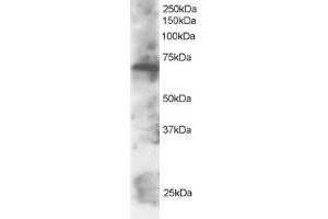 Western Blotting (WB) image for anti-SWAP Switching B-Cell Complex 70kDa Subunit (SWAP70) (C-Term) antibody (ABIN2466338) (SWAP70 Antikörper  (C-Term))