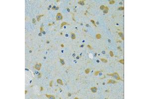 Immunohistochemistry of paraffin-embedded mouse brain using RPS7 antibody (ABIN5974069) at dilution of 1/100 (40x lens). (RPS7 Antikörper)