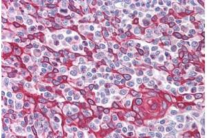 Human Thymus (formalin-fixed, paraffin-embedded) stained with TIMD4 antibody ABIN213994 at 5 ug/ml followed by biotinylated goat anti-rabbit IgG secondary antibody ABIN481713, alkaline phosphatase-streptavidin and chromogen. (TIMD4 Antikörper  (Internal Region))