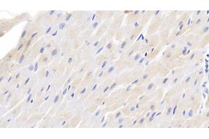 Detection of TGFb1 in Canine Cardiac Muscle Tissue using Polyclonal Antibody to Transforming Growth Factor Beta 1 (TGFb1) (TGFB1 Antikörper  (AA 279-390))