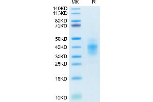 Human NKG2C&CD94 on Tris-Bis PAGE under reduced conditions. (NKG2C & CD94 protein (His-Avi Tag))