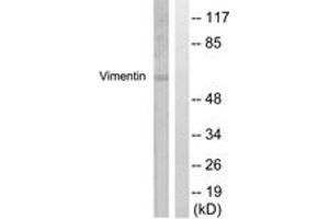 Western Blotting (WB) image for anti-Vimentin (VIM) (AA 31-80) antibody (ABIN2888938) (Vimentin Antikörper  (AA 31-80))