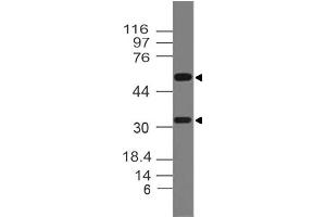 Image no. 1 for anti-Tumor Necrosis Factor (Ligand) Superfamily, Member 11 (TNFSF11) antibody (ABIN5027776) (RANKL Antikörper)