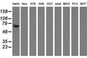 Western blot analysis of extracts (35 µg) from 9 different cell lines by using anti-AFP monoclonal antibody. (alpha Fetoprotein Antikörper)