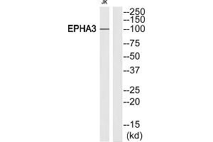 Western blot analysis of extracts from Jurkat cells, using EPHA3 (epitope around residue 602) antibody. (EPH Receptor A3 Antikörper)