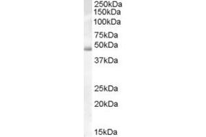 Western Blotting (WB) image for anti-DKFZp686H10114 (Middle Region) antibody (ABIN2779749) (DKFZp686H10114 (Middle Region) Antikörper)