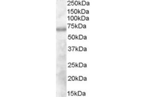 Western Blotting (WB) image for anti-Differentially Expressed in FDCP 6 Homolog (DEF6) (N-Term) antibody (ABIN2465595) (DEF6 Antikörper  (N-Term))