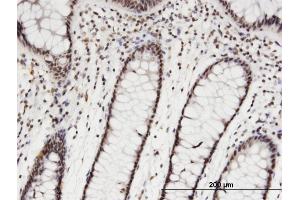 Immunoperoxidase of monoclonal antibody to CDC2L6 on formalin-fixed paraffin-embedded human colon. (CDK19 Antikörper  (AA 1-114))