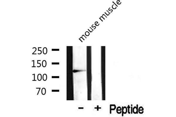 SKP2 Antikörper  (C-Term)