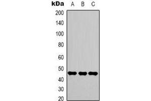 Western blot analysis of Gamma-enolase expression in Hela (A), Jurkat (B), 293T (C) whole cell lysates. (ENO2/NSE Antikörper)