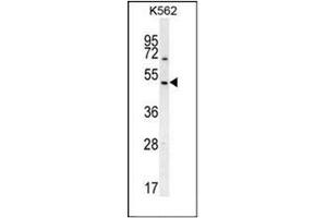Western blot analysis of RGS7 Antibody (C-term) Cat. (RGS7 Antikörper  (C-Term))