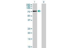 Lane 1: TBCD transfected lysate ( 69. (TBCD 293T Cell Transient Overexpression Lysate(Denatured))