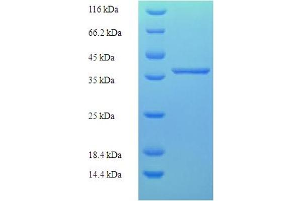 MLXIP Protein (AA 1-217, full length) (His-SUMO Tag)