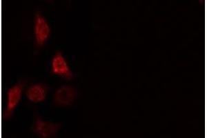 ABIN6275664 staining  HeLa cells by IF/ICC. (UBE2D2 Antikörper  (C-Term))