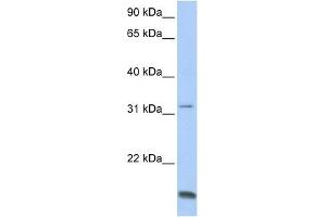 TCAP antibody used at 1 ug/ml to detect target protein. (TCAP Antikörper)