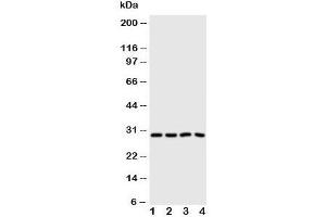 Western blot testing of Carbonic Anhydrase III antibody and Lane 1:  SMMC-7721;  2: HeLa;  3: SW620;  4: SCG cell lysate (CA3 Antikörper  (N-Term))