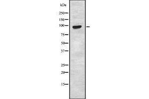 Western blot analysis TAS1R2 using HUVEC whole cell lysates. (TAS1R2 Antikörper)