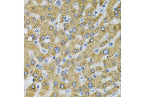 Immunohistochemistry of paraffin-embedded human liver injury using SDC4 Antibody (ABIN1874710) at dilution of 1:100 (40x lens). (SDC4 Antikörper)