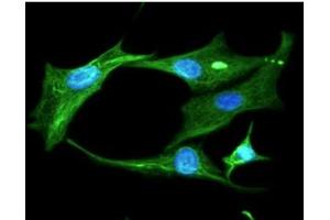 ICC/IF analysis of Clusterin in U87MG cells line, stained with DAPI (Blue) for nucleus staining and monoclonal anti-human Clusterin antibody (1:100) with goat anti-mouse IgG-Alexa fluor 488 conjugate (Green). (Clusterin Antikörper)