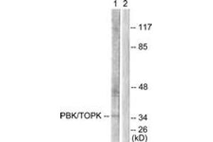 Western Blotting (WB) image for anti-PDZ Binding Kinase (PBK) (AA 1-50) antibody (ABIN2879108) (PBK Antikörper  (AA 1-50))
