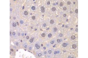 Immunohistochemistry of paraffin-embedded Mouse liver using FGFR1 Polyclonal Antibody at dilution of 1:100 (40x lens). (FGFR1 Antikörper)