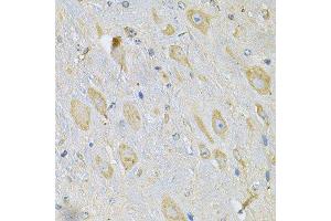 Immunohistochemistry of paraffin-embedded mouse brain using TXNDC5 Antibody. (TXNDC5 Antikörper  (AA 1-324))