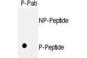 Image no. 1 for anti-Retinoblastoma 1 (RB1) (pSer811) antibody (ABIN358217) (Retinoblastoma 1 Antikörper  (pSer811))