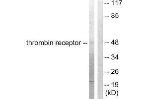 Western Blotting (WB) image for anti-Coagulation Factor II (thrombin) Receptor (F2R) (N-Term) antibody (ABIN1848803) (PAR1 Antikörper  (N-Term))