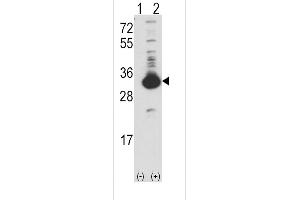 Western blot analysis of KHK (arrow) using rabbit polyclonal Ketohexokinase (KHK) Antibody (N-term) (ABIN391088 and ABIN2841229). (Ketohexokinase Antikörper  (N-Term))