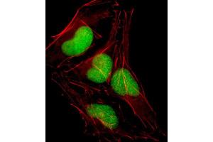 Immunofluorescence (IF) image for anti-SRY (Sex Determining Region Y)-Box 18 (SOX18) antibody (ABIN2998551) (SOX18 Antikörper)