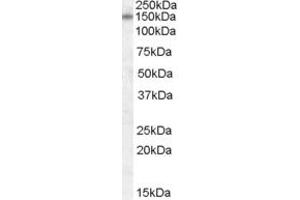 Western Blotting (WB) image for anti-Discs, Large Homolog 1 (DLG1) (AA 661-673) antibody (ABIN342982) (DLG1 Antikörper  (AA 661-673))