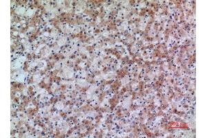 Immunohistochemistry (IHC) analysis of paraffin-embedded Human Liver, antibody was diluted at 1:100. (17beta-HSD4 (N-Term) Antikörper)