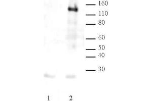 LexA DNA-binding Domain pAb tested by Western blot. (LexA (DNA Binding Domain) Antikörper)