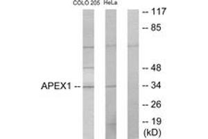 Western Blotting (WB) image for anti-Apurinic/Apyrimidinic Endonuclease 1 (APEX1) (AA 191-240) antibody (ABIN2889441) (APEX1 Antikörper  (AA 191-240))