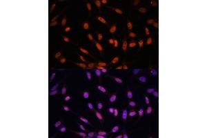Immunofluorescence analysis of NIH/3T3 cells using Twist antibody (ABIN6128846, ABIN6149715, ABIN6149718 and ABIN6223153) at dilution of 1:100. (TWIST1 Antikörper  (AA 103-202))