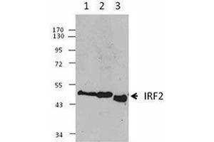 Western Blotting (WB) image for anti-Interferon Regulatory Factor 2 (IRF2) antibody (ABIN2665203) (IRF2 Antikörper)