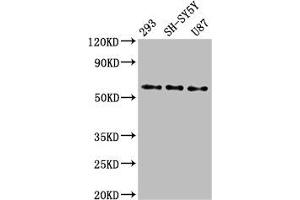 Western Blot Positive WB detected in: 293 whole cell lysate, SH-SY5Y whole cell lysate, U87 whole cell lysate All lanes: SLC11A2 antibody at 3 μg/mL Secondary Goat polyclonal to rabbit IgG at 1/50000 dilution Predicted band size: 63, 62, 65, 66 kDa Observed band size: 63 kDa (SLC11A2 Antikörper  (AA 1-69))