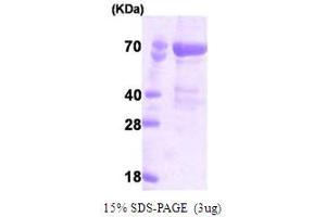 PAK4 Protein (AA 1-591) (His tag)