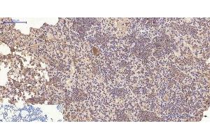 Immunohistochemistry of paraffin-embedded Mouse lung tissue using CD10 Monoclonal Antibody at dilution of 1:200. (MME Antikörper)