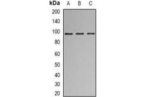 Western blot analysis of Nibrin expression in HEK293T (A), A549 (B), Jurkat (C) whole cell lysates. (Nibrin Antikörper)