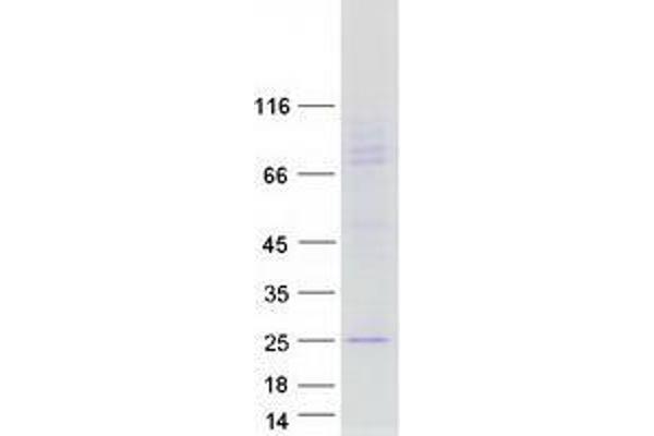 TUSC5 Protein (Myc-DYKDDDDK Tag)