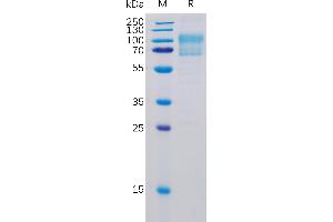 Human B7-1 Protein, mFc-His Tag on SDS-PAGE under reducing condition. (CD80 Protein (CD80) (AA 35-242) (mFc-His Tag))