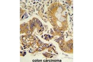 Immunohistochemistry (IHC) image for anti-Chloride Channel, Nucleotide-Sensitive, 1A (CLNS1A) antibody (ABIN3002661) (CLNS1A Antikörper)