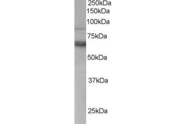 ANTXR1 Antikörper  (C-Term)