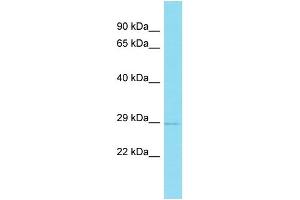 Host:  Rabbit  Target Name:  Rybp  Sample Type:  Mouse Thymus lysates  Antibody Dilution:  1. (RYBP Antikörper  (N-Term))