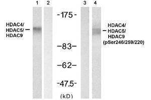 Western blot analysis of extracts from 3T3 cell using HDAC4/ HDAC5/HDAC9 (Ab-246/259/220) Antibody (E021517, Lane 1 and 2) and HDAC4/ HDAC5/HDAC9 (phospho- Ser246/ 259/ 220) Antibody (E011517, Lane 3 and 4). (HDAC4/HDAC5/HDAC9 Antikörper)
