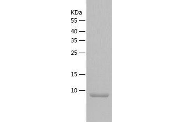 Neurogranin Protein (NRGN) (AA 1-78) (His tag)