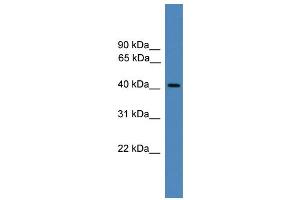 WB Suggested Anti-PSMC6 Antibody Titration: 0. (PSMC6 Antikörper  (C-Term))