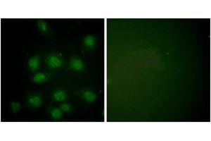 Immunofluorescence analysis of HuvEc cells, using NIFK (Phospho-Thr234) Antibody. (NIFK Antikörper  (pThr234))